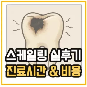 서울대입구역-치과-스케일링-실후기-진료시간-비용